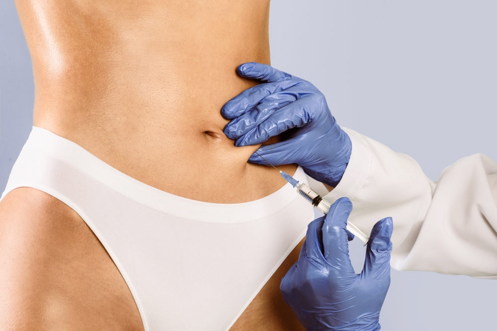 Most Searched Lipo Injection Treatments in Rosemont, PA: Explained