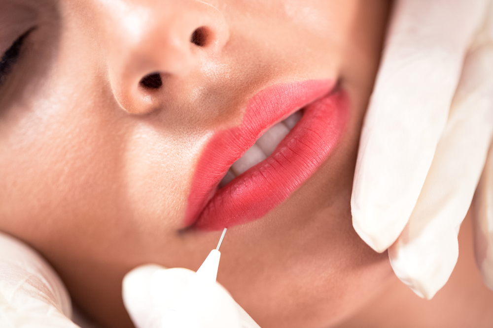 What’s the Longest-Lasting Lip Filler in Bryn Mawr: A Guide to Juvederm & Versa