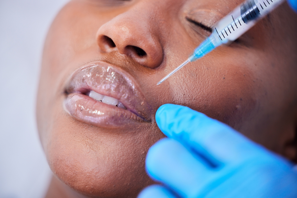 Lip Filler Appointments in Bryn Mawr