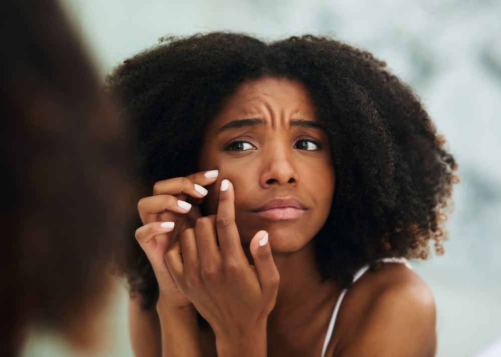 Acne Specialist in Bryn Mawr, Pennsylvania