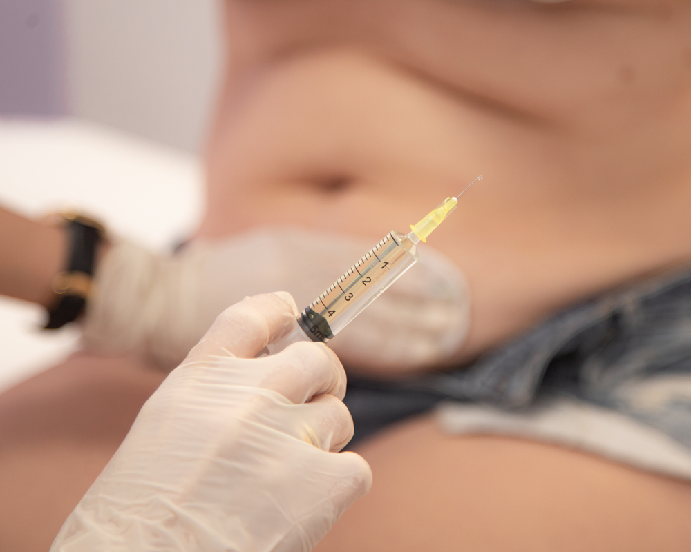 Liposuction Shot Prices in Bryn Mawr Pennsylvania