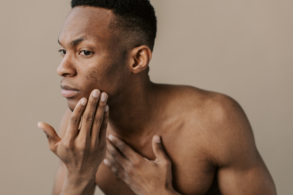 Same-Day Botox Appointment for Acne and Oily Skin Near Center City, Philadelphia