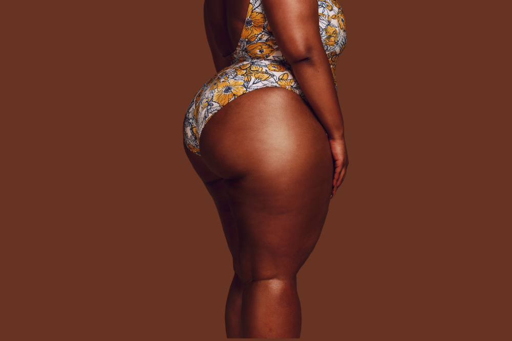 Brazilian Butt Lift Best Results Near King of Prussia, PA