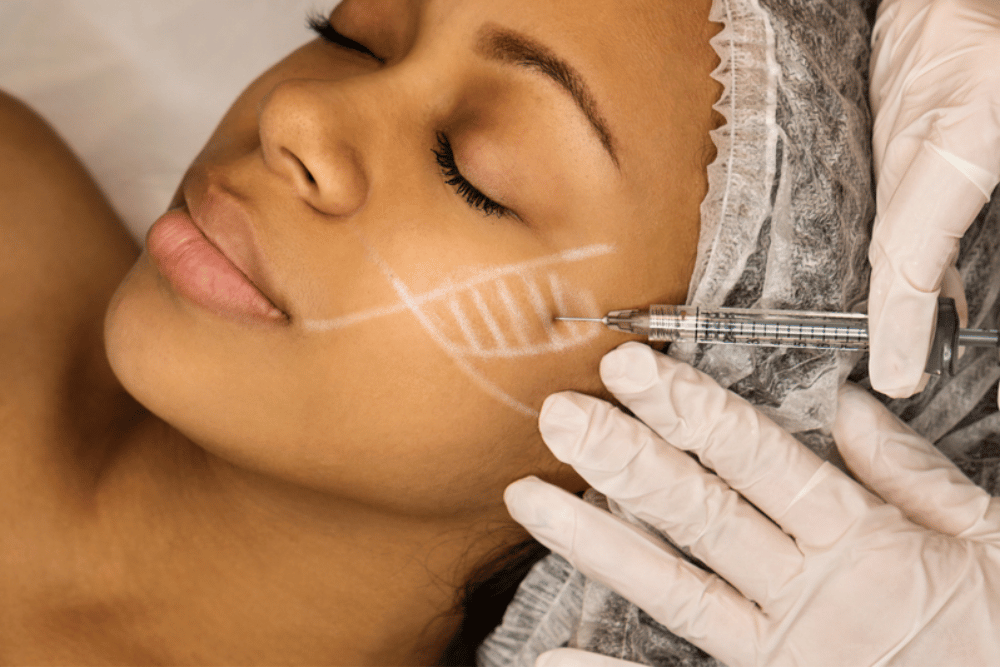 Dermal Filler Cost Near Blue Bell Pennsylvania