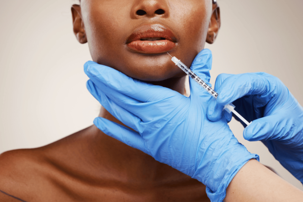 Lip Filler Prices in Villanova Pennsylvania