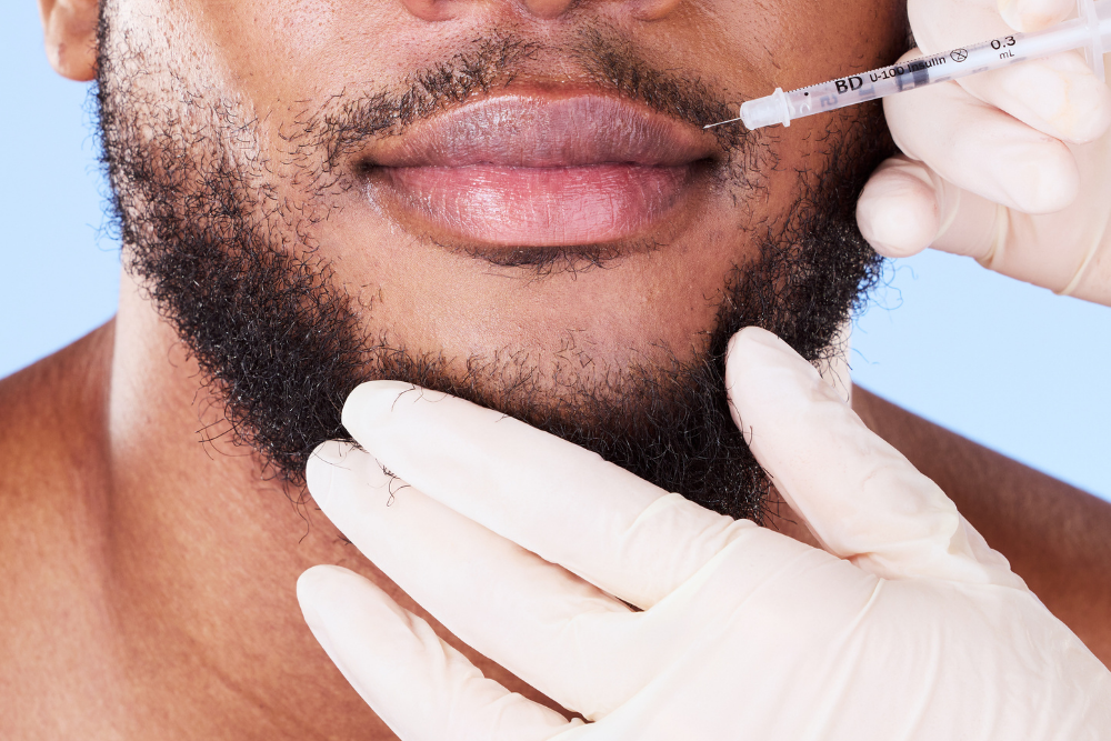 Lip Filler Near Bryn Mawr PA