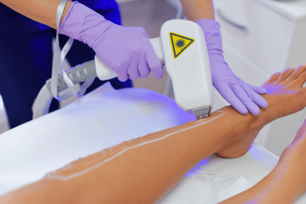 Laser Hair Removal in Bryn Mawr Pennsylvania